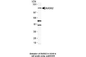 Image no. 1 for anti-Dual Oxidase 2 (DUOX2) (AA 400-500) antibody (ABIN363629) (DUOX2 anticorps  (AA 400-500))