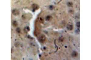 Used in DAB staining on fromalin fixed paraffin-embedded Brain tissue