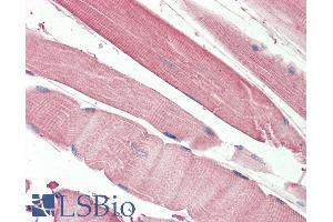 ABIN5539899 (5µg/ml) staining of paraffin embedded Human Skeletal Muscle. (THNSL2 anticorps  (AA 192-204))