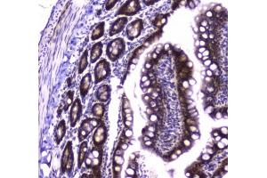 IHC testing of FFPE rat small intestine tissue with Glutathione Reductase antibody at 1ug/ml. (Glutathione Reductase anticorps)