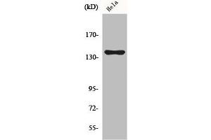 Western Blot analysis of COLO205 cells using KIF4A Polyclonal Antibody (KIF4A anticorps  (C-Term))