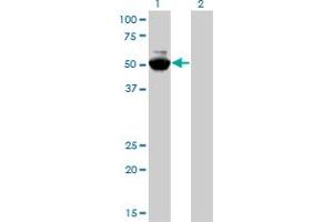 Western Blot analysis of MYCN expression in transfected 293T cell line by MYCN monoclonal antibody (M01), clone 3H4.