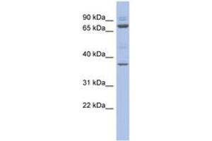 Image no. 1 for anti-Metal Response Element Binding Transcription Factor 2 (MTF2) (AA 359-408) antibody (ABIN6742455) (MTF2 anticorps  (AA 359-408))