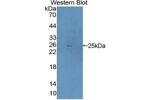 Detection of Recombinant DTNBP1, Mouse using Polyclonal Antibody to Dystrobrevin Binding Protein 1 (DTNBP1)