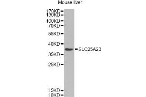 Western blot analysis of extracts of mouse liver, using SLC25A20 Antibody (ABIN6291312) at 1:1000 dilution. (SLC25A20 anticorps)