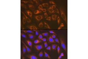 Immunofluorescence analysis of U-2 OS cells using LysRS/KARS Rabbit mAb (ABIN7268350) at dilution of 1:100 (40x lens). (KARS anticorps)