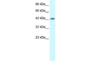 Human Jurkat; WB Suggested Anti-LHX3 Antibody Titration: 1. (LHX3 anticorps  (Middle Region))