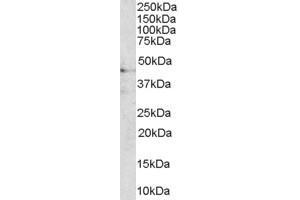 Western Blotting (WB) image for anti-AT-Hook Transcription Factor (AKNA) (C-Term) antibody (ABIN2790351)