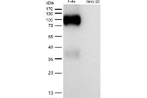 All lanes use the Antibody at 1:1K dilution for 1 hour at room temperature.