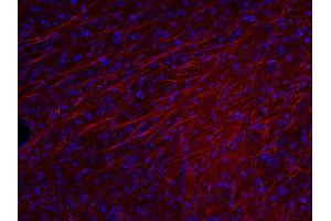 Indirect immunostaining of PFA fixed mouse brain section (dilution 1 : 500; red).