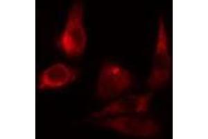 ABIN6275492 staining LOVO cells by IF/ICC. (ARHGAP9 anticorps  (Internal Region))