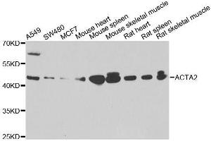 Western blot analysis of extracts of various cell lines, using ACTA2 antibody. (Smooth Muscle Actin anticorps  (AA 1-124))