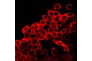 Immunofluorescent analysis of BAX staining in LOVO cells. (BAX anticorps  (C-Term))