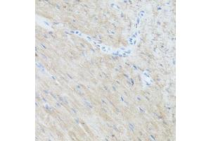 Immunohistochemistry of paraffin-embedded mouse heart using CLUH antibody  at dilution of 1:100 (40x lens). (CLUH anticorps  (AA 1120-1309))