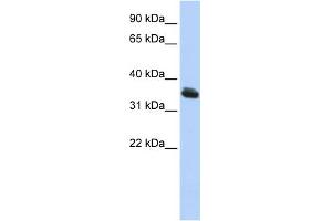 WB Suggested Anti-LHX3 Antibody Titration:  0. (LHX3 anticorps  (Middle Region))