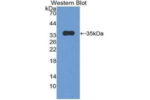 Western Blotting (WB) image for anti-Plakophilin 2 (PKP2) (AA 571-849) antibody (ABIN2119569) (Plakophilin 2 anticorps  (AA 571-849))