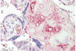 Image no. 2 for anti-Purinergic Receptor P2Y, G-Protein Coupled, 1 (P2RY1) (AA 71-120) antibody (ABIN6749750)