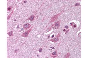 Anti-TMED10 / TMP21 antibody IHC of human brain, cortex. (TMED10 anticorps  (Internal Region))
