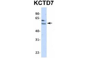 Host:  Rabbit  Target Name:  KCTD7  Sample Type:  Human Adult Placenta  Antibody Dilution:  1.