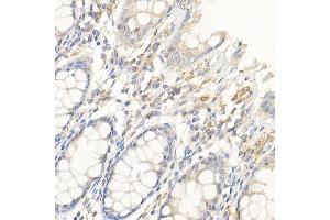 Immunohistochemistry of paraffin-embedded human colon using IL21 Rabbit pAb (ABIN6128086, ABIN6142359, ABIN6142360 and ABIN6223071) at dilution of 1:50 (40x lens). (IL-21 anticorps  (AA 25-162))