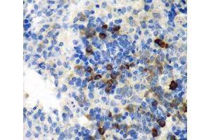 Immunohistochemistry of paraffin-embedded Rat spleen using AIMP1 Polyclonal Antibody at dilution of 1:100 (40x lens). (AIMP1 anticorps)