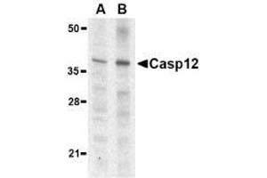 Western blot analysis of caspase-12 in mouse (lane A) and rat (lane B) liver lysate with AP30193PU-N caspase-12 antibody (small) at 1 μg/ml. (Caspase 12 anticorps  (small))