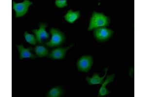 Immunofluorescence staining of A549 cells with ABIN7160660 at 1:50, counter-stained with DAPI. (MTMR9 anticorps  (AA 322-549))