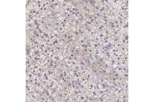 Immunohistochemical staining of human adrenal gland with TBC1D22A polyclonal antibody  shows moderate cytoplasmic and membranous positivity in cortical cells. (TBC1D22A anticorps)