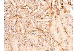 ABIN6267073 at 1/100 staining mouse kidney tissue sections by IHC-P. (CHEK1 anticorps  (pSer280))