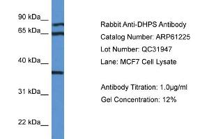 Western Blotting (WB) image for anti-Deoxyhypusine Synthase (DHPS) (N-Term) antibody (ABIN2788727) (DHPS anticorps  (N-Term))