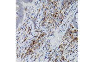 Immunohistochemistry of paraffin-embedded mouse lung using ASC/TMS1 Rabbit pAb (ABIN6131200, ABIN6146515, ABIN6146516 and ABIN6215212) at dilution of 1:150 (40x lens). (PYCARD anticorps  (AA 50-195))