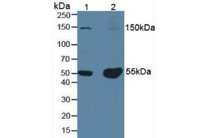 Western blot analysis of (1) Mouse Testis Tissue and (2) Mouse Brain Tissue. (PINP anticorps)