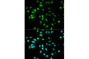 Immunofluorescence analysis of MCF-7 cells using PAX3 antibody (ABIN5970834). (Paired Box 3 anticorps)