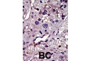 Immunohistochemistry (IHC) image for anti-Uridine-Cytidine Kinase (UCK) antibody (ABIN3003699)