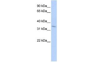 TNFRSF25 antibody (70R-10465) used at 0. (DR3/LARD anticorps  (Middle Region))