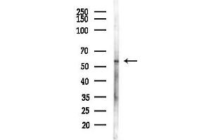 Western blot analysis of lysates from B16F10-LUC cells(UV,30 min treatment), using Phospho-HBP1 (Ser402) Antibody at 1/1000 dilution.