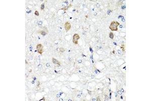 Immunohistochemistry of paraffin-embedded rat brain using RBP2 antibody at dilution of 1:100 (x40 lens). (RBP2 anticorps)