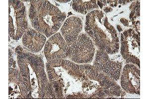 Image no. 7 for anti-Ubiquitin-Conjugating Enzyme E2G 2 (UBE2G2) antibody (ABIN1501634)