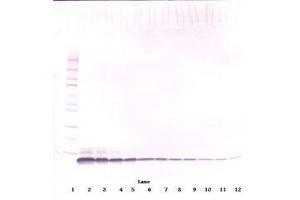 Image no. 2 for anti-Epidermal Growth Factor (EGF) antibody (ABIN465662) (EGF anticorps)
