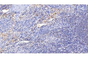 Detection of IL15 in Porcine Spleen Tissue using Polyclonal Antibody to Interleukin 15 (IL15) (IL-15 anticorps  (AA 49-162))