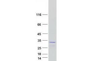 Validation with Western Blot
