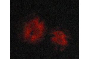 ABIN6269125 staining MCF-7 cells by ICC/IF.