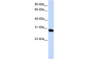 WB Suggested Anti-PHF19 Antibody Titration:  0. (PHF19 anticorps  (C-Term))