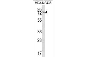 UNC84B Antibody (Center) (ABIN656370 and ABIN2845665) western blot analysis in MDA-M cell line lysates (35 μg/lane). (SUN2 anticorps  (AA 237-265))