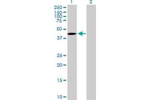 Western Blot analysis of TBC1D20 expression in transfected 293T cell line by TBC1D20 MaxPab polyclonal antibody. (TBC1D20 anticorps  (AA 1-403))
