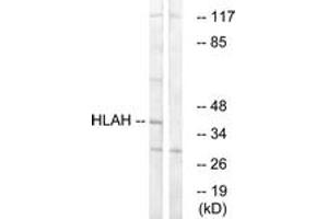 anti-Major Histocompatibility Complex, Class I, H (Pseudogene) (HLA-H) (AA 71-120) antibody