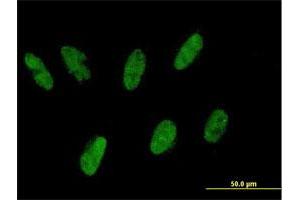 Immunofluorescence of purified MaxPab antibody to ZNF343 on HepG2 cell.