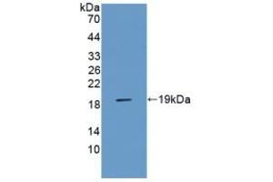 Detection of Recombinant AGER, Rat using Polyclonal Antibody to Receptor For Advanced Glycation Endproducts (RAGE) (RAGE anticorps  (AA 180-402))