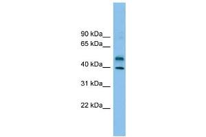 WB Suggested Anti-ZNF784 Antibody Titration: 0. (ZNF784 anticorps  (Middle Region))