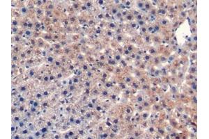 Detection of CD40L in Rat Liver Tissue using Monoclonal Antibody to Cluster Of Differentiation 40 Ligand (CD40L) (CD40 Ligand anticorps  (AA 105-260))
